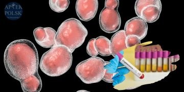 Kryptokokoza - poważny problem u pacjentów z immunosupresją
